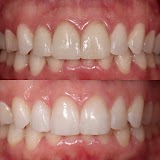 Dentists in Brickell - HQ Dontics Dental Centre — dentist in Miami