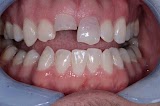 Downtown Dental — dentist in Los Angeles