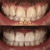 Birmingham Dental Excellence — dentist in Birmingham